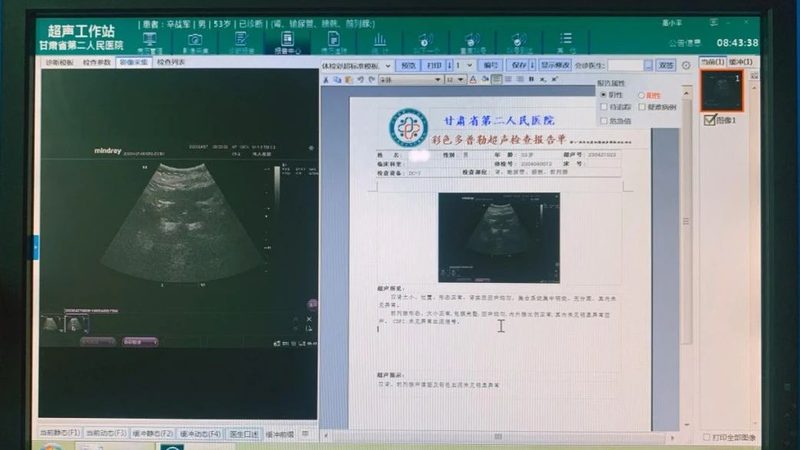 在解读婚前体检报告时，我们需要参考正常范围。以下是一些常见指标的正常范围：